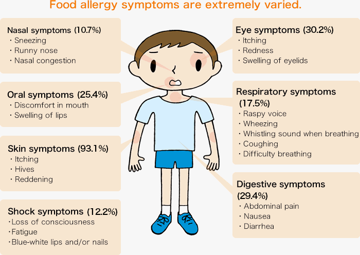 Illustration of food allergy symptoms