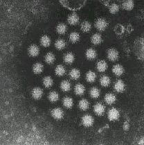 写真　ノロウイルスの電子顕微鏡写真