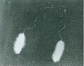 写真　腸炎ビブリオの電子顕微鏡写真