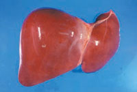 写真　正常な肝臓