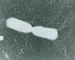 Photo:Bacillus cereus
