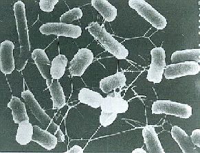 Photo：Escherichia coli