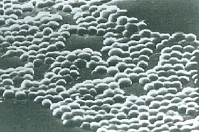 Photo:Staphylococcus aureus