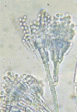写真：ペニシリウム・ベロコーサムの顕微鏡写真