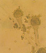 写真：ユーロチウム・アムステロダミの顕微鏡写真