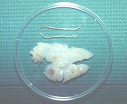 写真：アンコウの肝臓に寄生しているシュードテラノーバ
