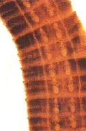 写真：大腹裂門条虫の拡大写真（染色標本）