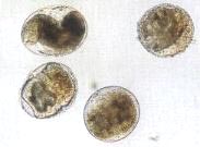 写真：横川吸虫の被嚢幼虫（メタセルカリア）