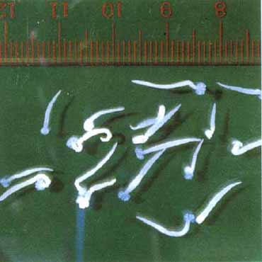 写真：シロギスの筋肉に寄生している四吻目条虫類の幼虫の一種