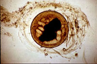 写真：宮崎肺吸虫のメタセルカリア